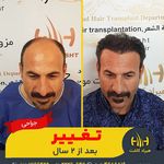 تصویر محیط دپارتمان تخصصی کاشت مو کاشت ابرو هیراد