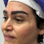 تصویر محیط کاشت ابرو دائمی