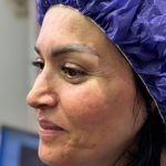 تصویر محیط کاشت ابرو دائمی