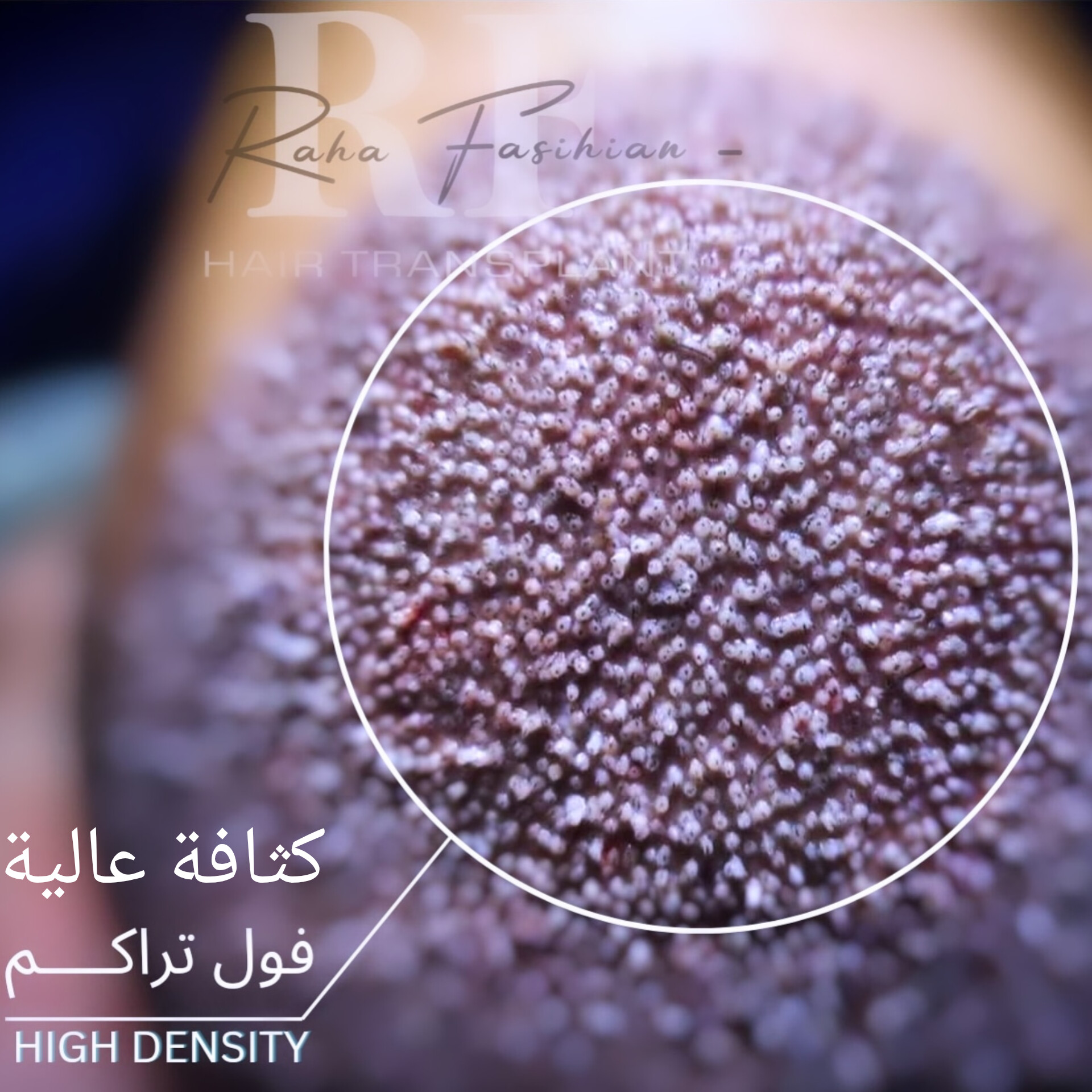 تصویر محیط کلینیک تخصصی کاشت مو و ابرو تهران