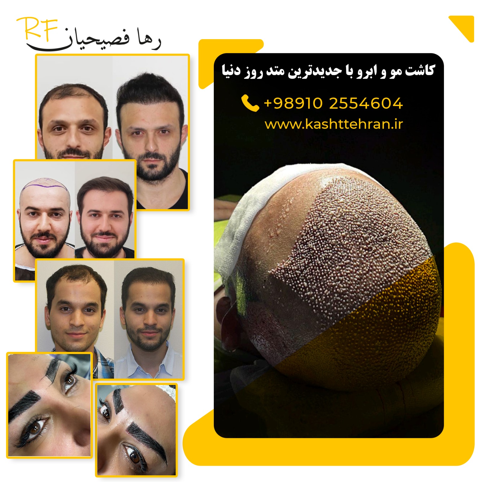 تصویر محیط کلینیک تخصصی کاشت مو و ابرو تهران