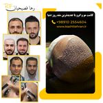 تصویر محیط کلینیک تخصصی کاشت مو و ابرو تهران