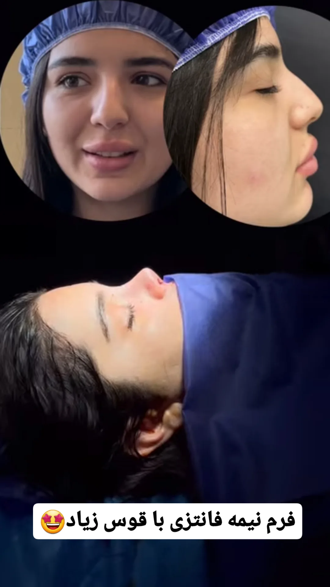 تصویر محیط جراحی بینی زهرا روشنی