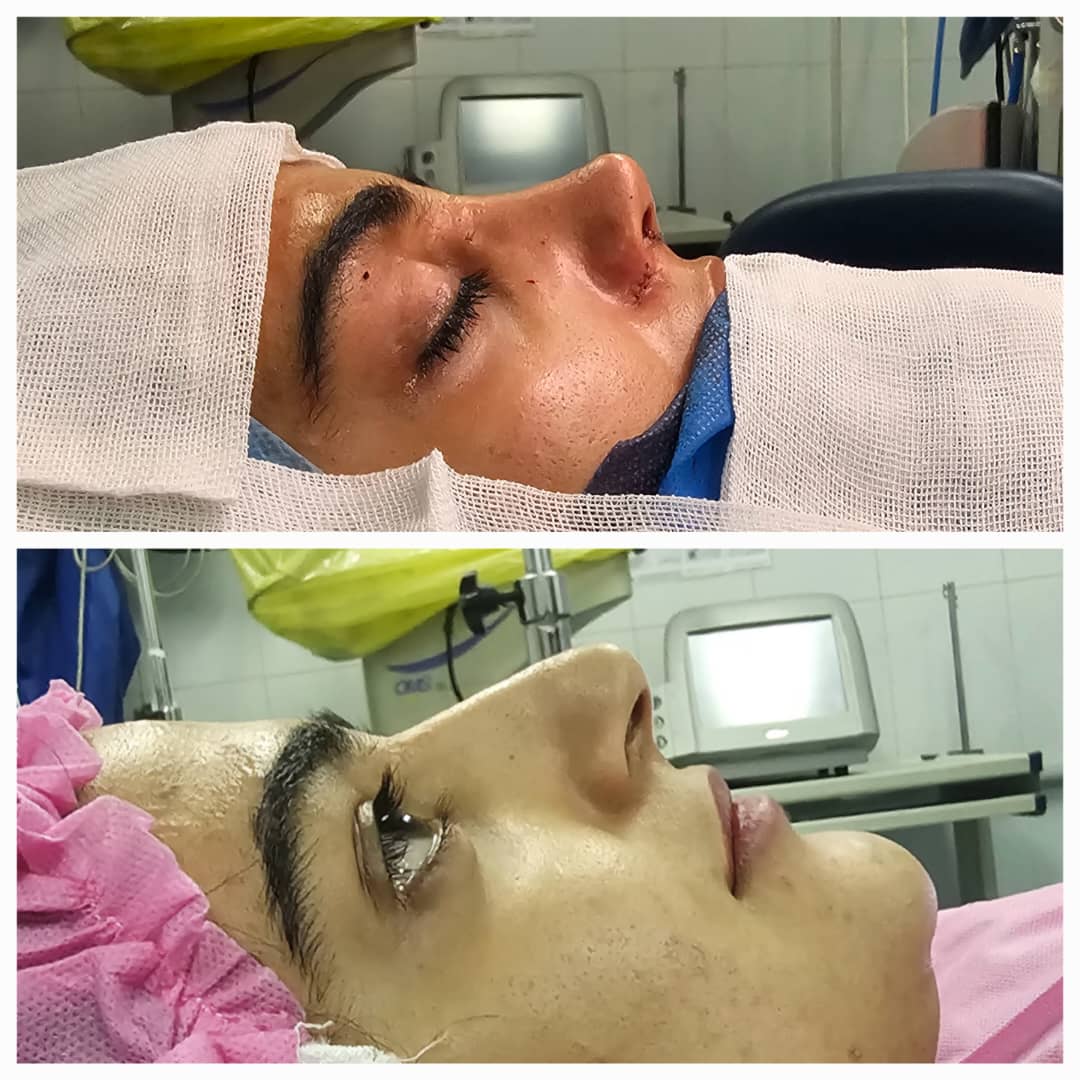 تصویر محیط جراحی زیبایی بینی و صورت نئوفیس