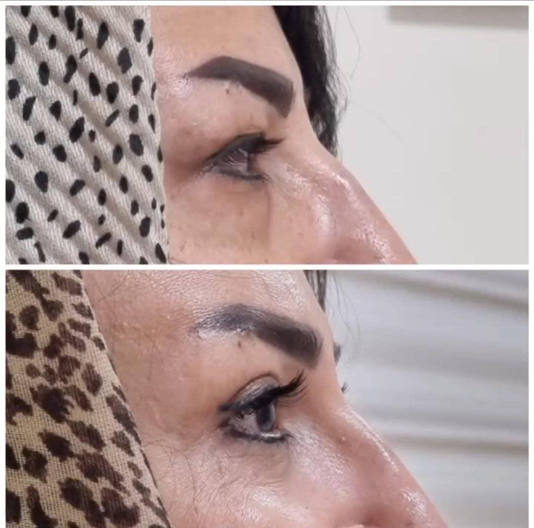 تصویر محیط جراحی زیبایی بینی و صورت نئوفیس