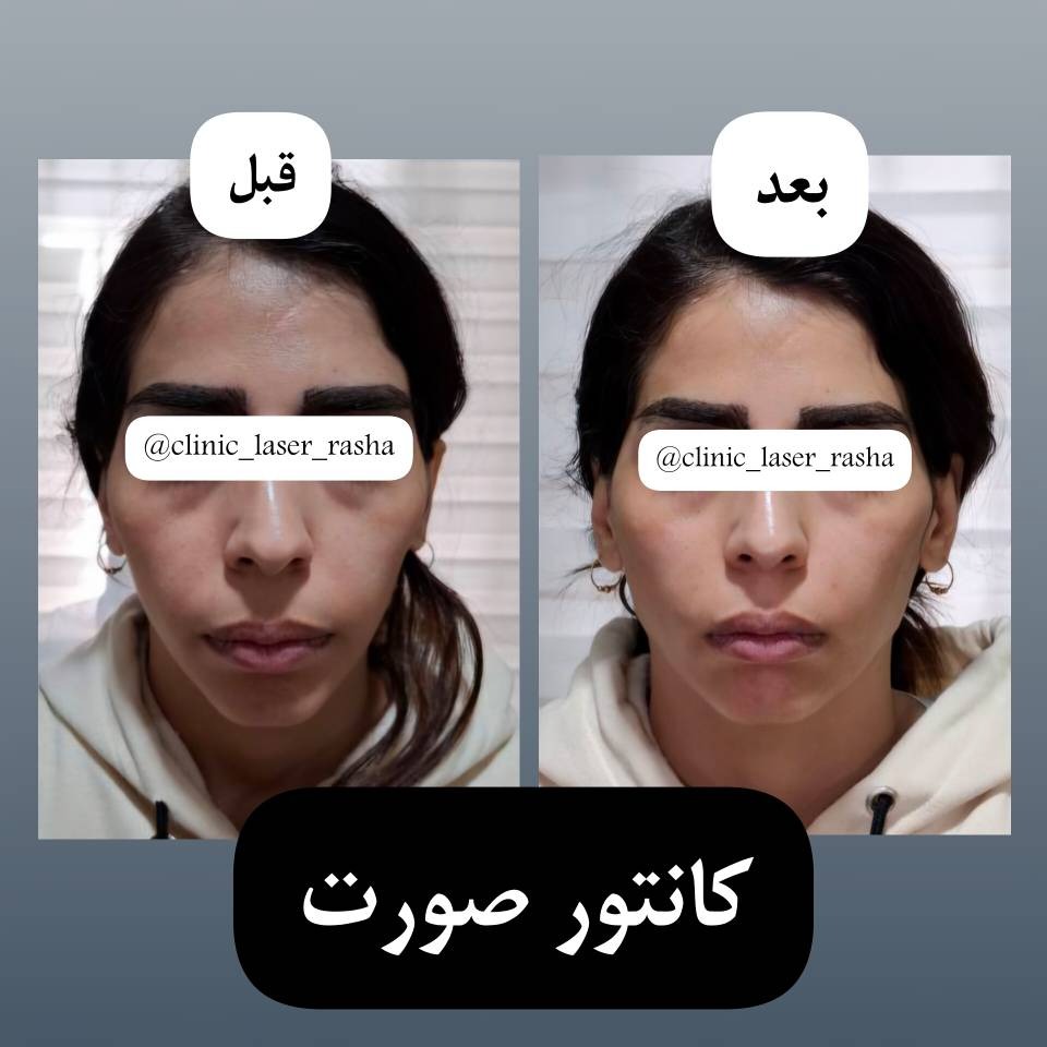 تصویر محیط کلینیک تخصصی لیزر و زیبایی راشا