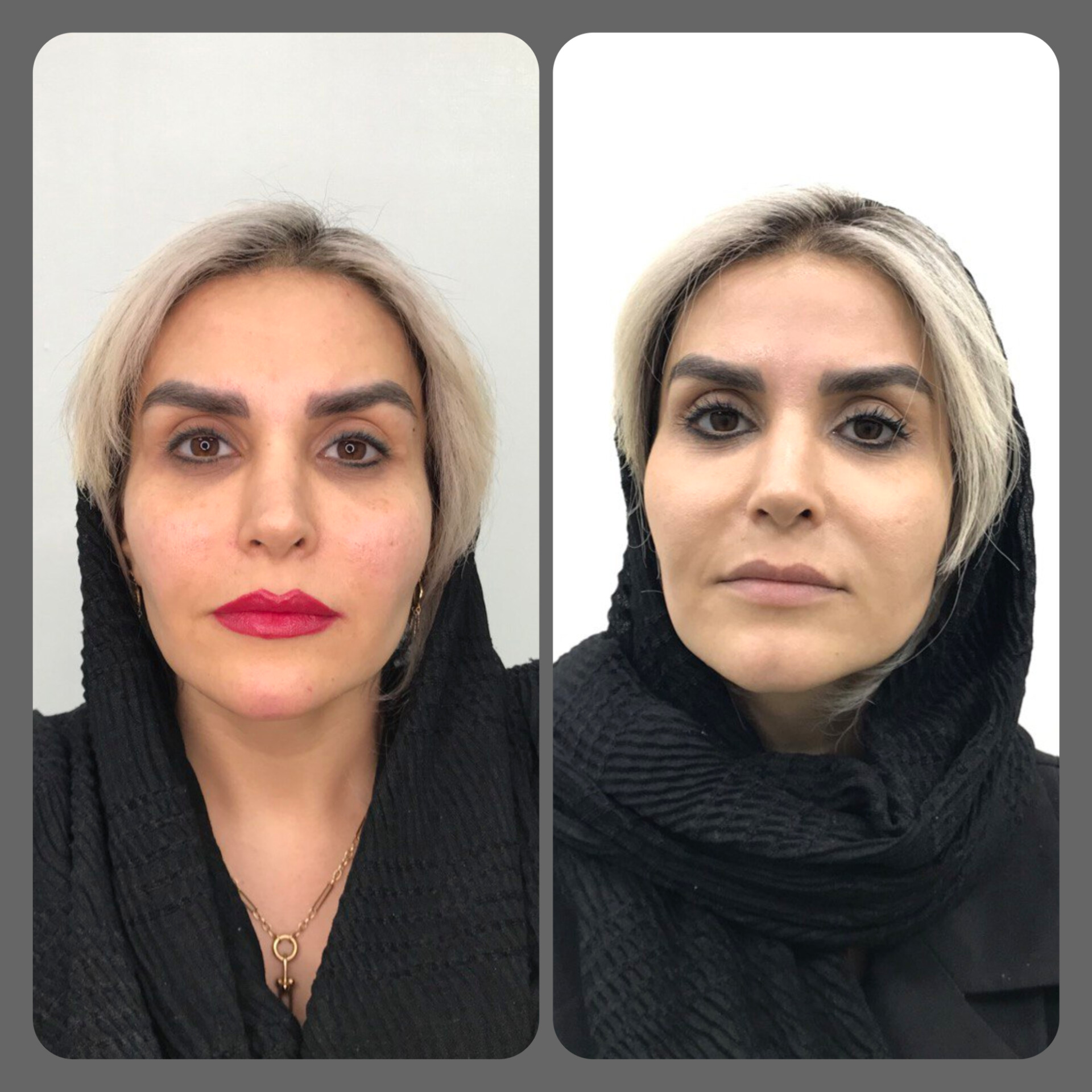 تصویر محیط کلینیک لیزر و زیبایی مهرُنا