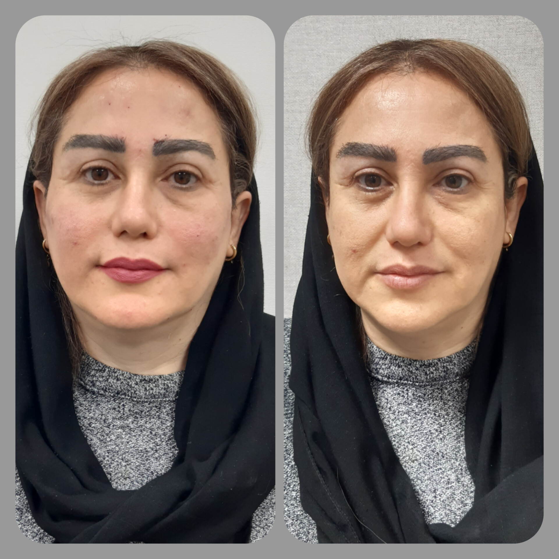 تصویر محیط کلینیک لیزر و زیبایی مهرُنا