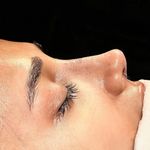 تصویر محیط جراح زیبایی بینی توسط فوق تخصص