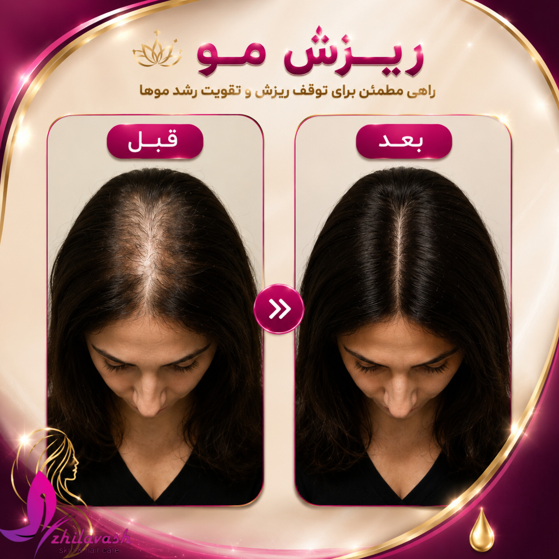 تصویر محیط کلینیک پوست و زیبایی ژیلاوَش
