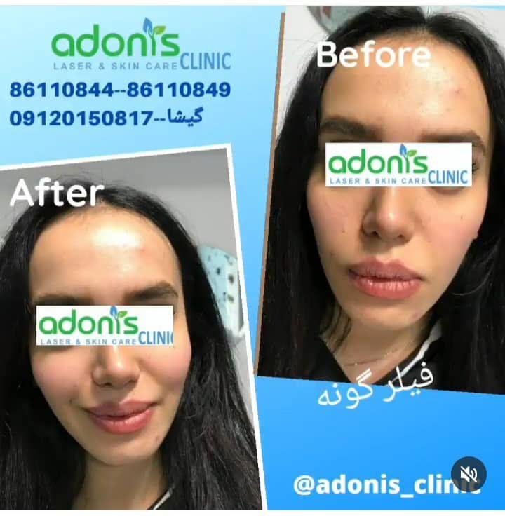 تصویر محیط کلینیک پوست مو زیبایی و لیزر آدونیس