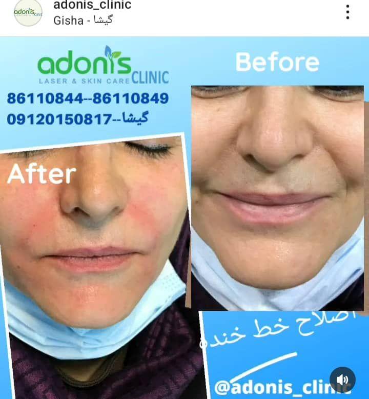 تصویر محیط کلینیک پوست مو زیبایی و لیزر آدونیس