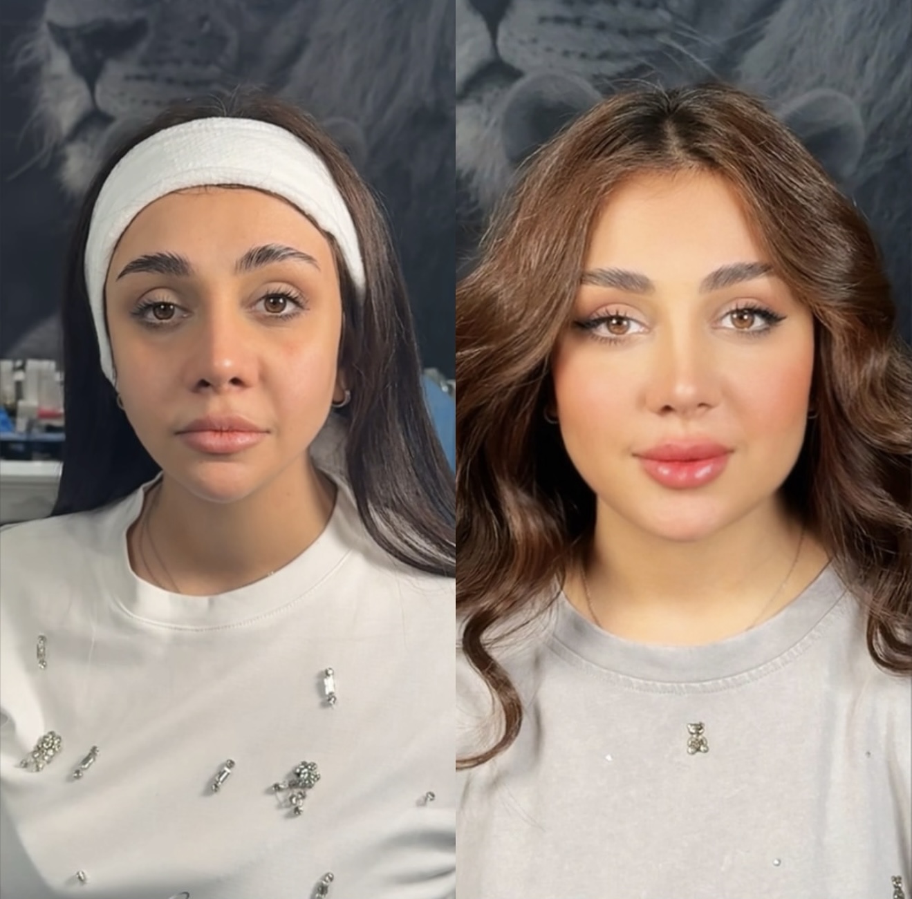 تصویر محیط کلینیک زیبایی و جراحی دکتر محسن حسینی