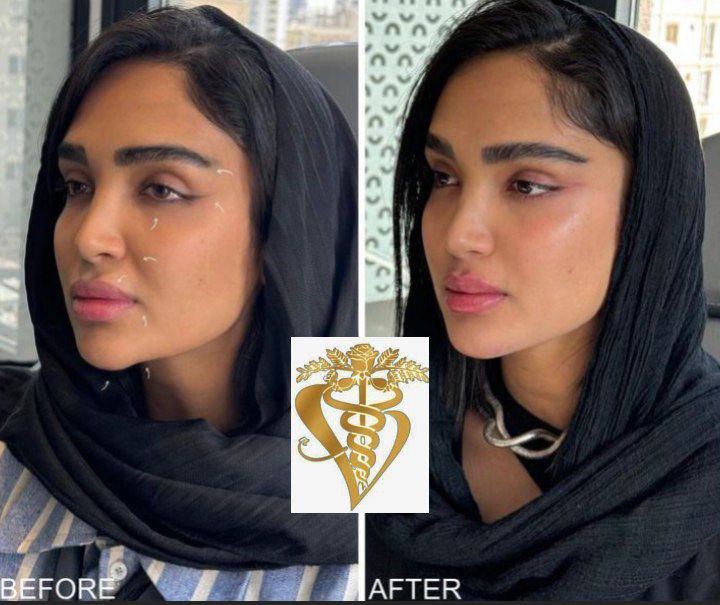 تصویر محیط وایتال فورس