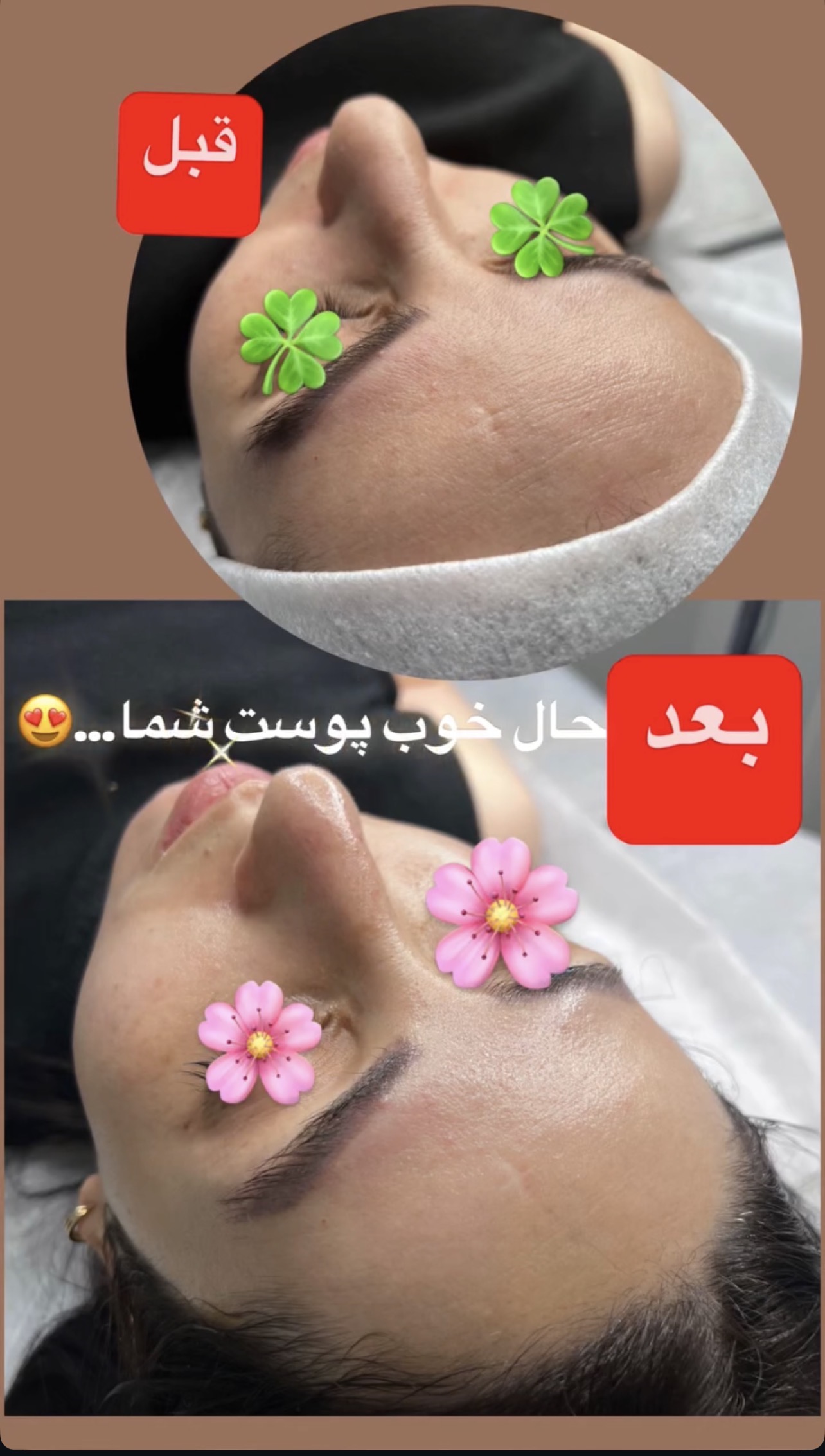 تصویر محیط فشیال و اسکراب اسکالپ کلینیک بلا